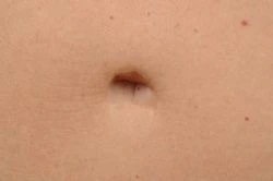 Tummy Tuck