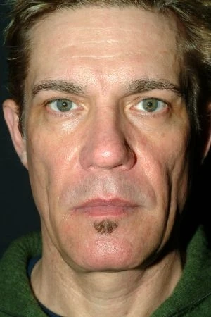 Sculptra Aesthetic Virginia Beach